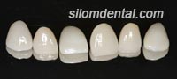Dental Extreme Makeover
